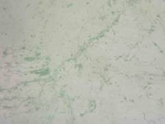 u=1342370326,3077030127&amp;fm=170&amp;s=A51AE27DCB8347660E45245A0100C0F3&amp;w=240&amp;h=180&amp;im.jpg